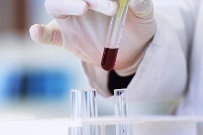 2018年全球濕電子化學品產業發展現狀 電子化學品｜2018年全球濕電子化學品產業發展現狀 